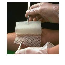 GARZA MEDICATA BACTIGRAS CON CLOREXIDINA ACETATO 0,5% 10X10CM 10 PEZZI - Farmacia Artemisia di Montecuollo Dott. Angelo snc