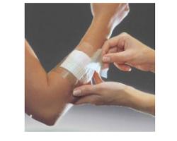 FILM ADESIVO IN POLIURETANO IN ROTOLO TRASPARENTE IMPERMEABILE PER FISSAGGIO DI MEDICAZIONI E CATETERI 10X1000CM 1 PEZZO - Farmacia Artemisia di Montecuollo Dott. Angelo snc